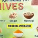 Natural Herbal Remedies for Hives Relief Today | The Ultimate Herbal Remedies Guide: Natural Healing for a Healthier Life