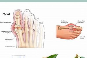 Top: Best Herbal Remedy for Gout Relief [Guide] | The Ultimate Herbal Remedies Guide: Natural Healing for a Healthier Life