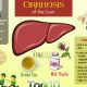 Natural Herbal Remedies for Liver Cirrhosis: Is There Hope? | The Ultimate Herbal Remedies Guide: Natural Healing for a Healthier Life
