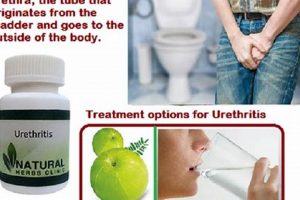 Natural Urethritis Herbal Treatment: Relief & Remedies | The Ultimate Herbal Remedies Guide: Natural Healing for a Healthier Life