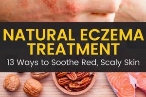 Natural Eczema Treatment Herbal Remedy: Soothe Skin | The Ultimate Herbal Remedies Guide: Natural Healing for a Healthier Life