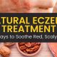 Natural Eczema Treatment Herbal Remedy: Soothe Skin | The Ultimate Herbal Remedies Guide: Natural Healing for a Healthier Life