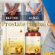 Guide: North Moon Prostate Capsules - Usage & Benefits | The Ultimate Herbal Remedies Guide: Natural Healing for a Healthier Life