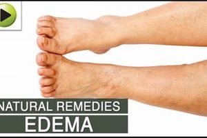 Natural Herbal Remedies for Edema in Legs: Relief Tips | The Ultimate Herbal Remedies Guide: Natural Healing for a Healthier Life