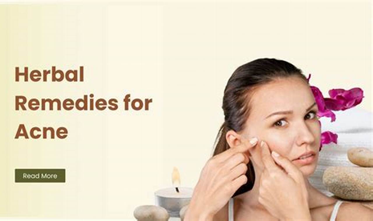 Natural Herbal Remedies for Acne Scars: Clear Skin Now! The Ultimate Herbal Remedies Guide: Natural Healing for a Healthier Life Natural Herbal Remedies for Acne Scars: Clear Skin Now! | The Ultimate Herbal Remedies Guide: Natural Healing for a Healthier Life
