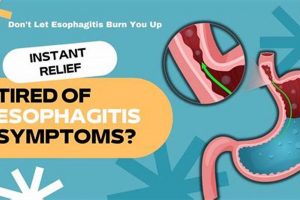 Natural Esophagitis Herbal Treatment: Relief &amp; Remedies | The Ultimate Herbal Remedies Guide: Natural Healing for a Healthier Life