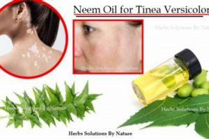 Natural Relief: Tinea Versicolor Herbal Treatment Guide | The Ultimate Herbal Remedies Guide: Natural Healing for a Healthier Life