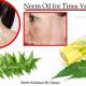 Natural Relief: Tinea Versicolor Herbal Treatment Guide | The Ultimate Herbal Remedies Guide: Natural Healing for a Healthier Life