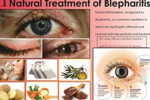 Natural Blepharitis Herbal Treatment: Soothe Eyes Fast The Ultimate Herbal Remedies Guide: Natural Healing for a Healthier Life Natural Blepharitis Herbal Treatment: Soothe Eyes Fast | The Ultimate Herbal Remedies Guide: Natural Healing for a Healthier Life