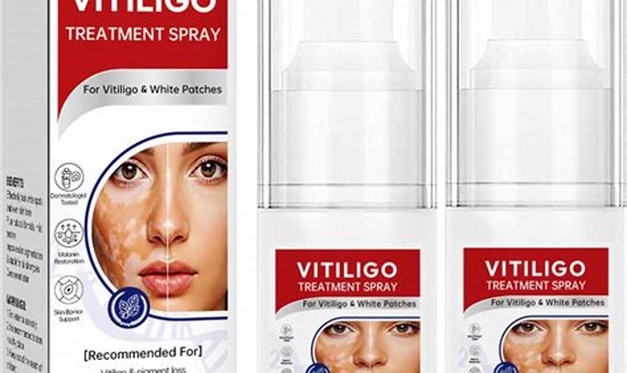 Natural Boost: Herbal Treatment for Vitiligo Support | The Ultimate Herbal Remedies Guide: Natural Healing for a Healthier Life