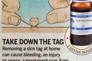 Natural Herbal Treatment for Skin Tags: A Gentle Approach The Ultimate Herbal Remedies Guide: Natural Healing for a Healthier Life Natural Herbal Treatment for Skin Tags: A Gentle Approach | The Ultimate Herbal Remedies Guide: Natural Healing for a Healthier Life