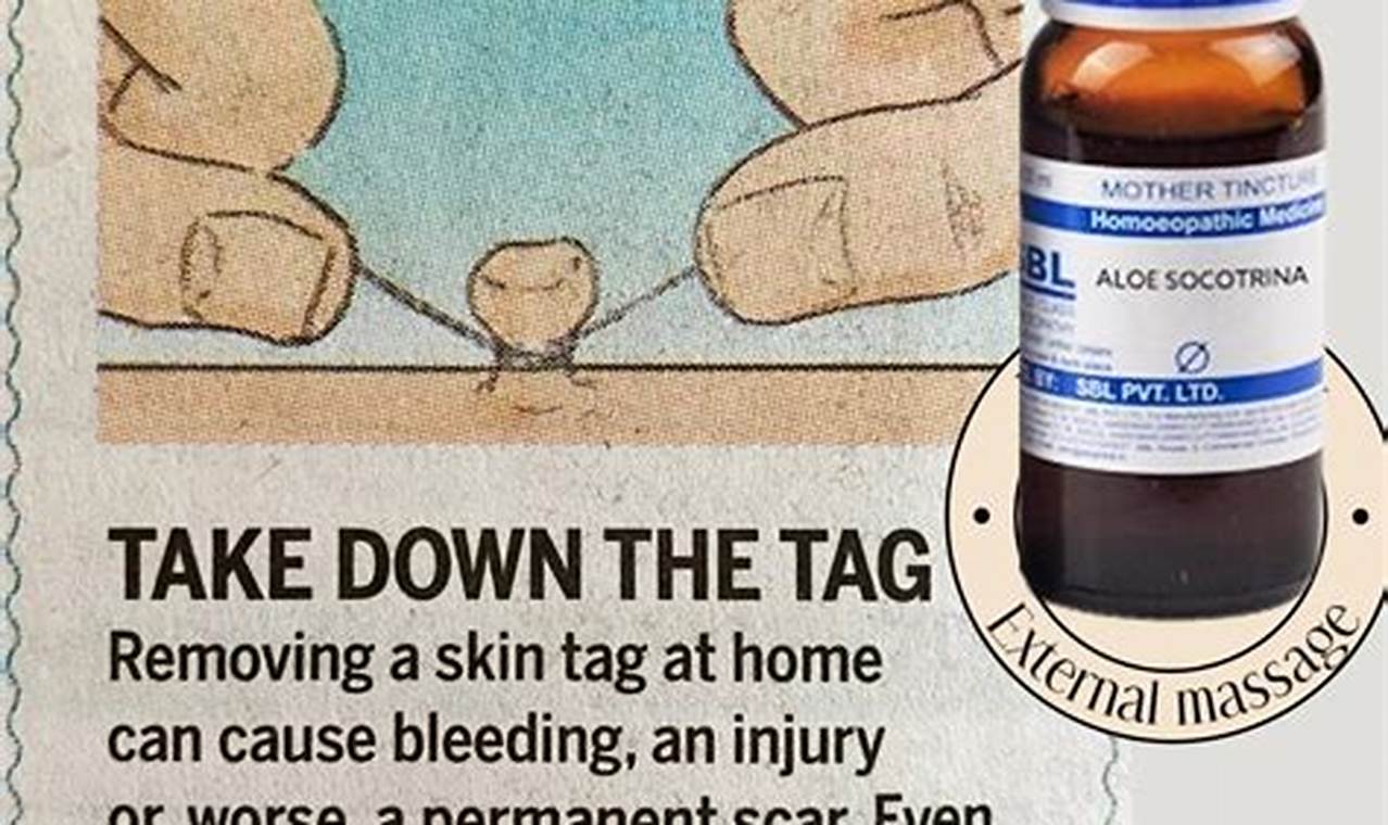 Natural Herbal Treatment for Skin Tags: A Gentle Approach The Ultimate Herbal Remedies Guide: Natural Healing for a Healthier Life Natural Herbal Treatment for Skin Tags: A Gentle Approach | The Ultimate Herbal Remedies Guide: Natural Healing for a Healthier Life