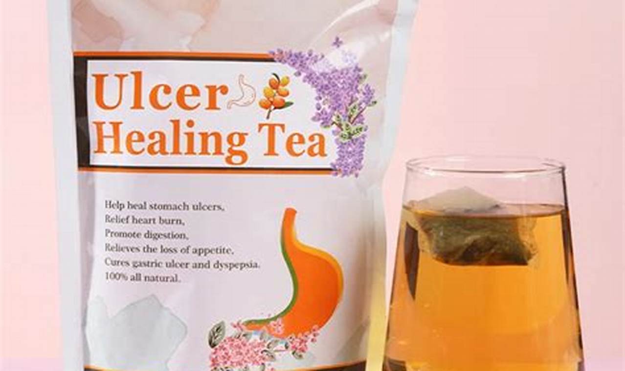 Natural Ulcer Herbal Remedies: Soothe & Heal The Ultimate Herbal Remedies Guide: Natural Healing for a Healthier Life Natural Ulcer Herbal Remedies: Soothe & Heal | The Ultimate Herbal Remedies Guide: Natural Healing for a Healthier Life