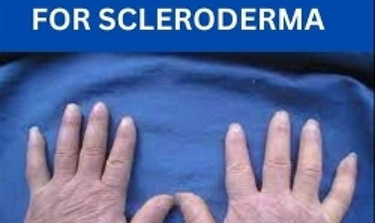 Natural Scleroderma Herbal Remedies: Relief + Support The Ultimate Herbal Remedies Guide: Natural Healing for a Healthier Life Natural Scleroderma Herbal Remedies: Relief + Support | The Ultimate Herbal Remedies Guide: Natural Healing for a Healthier Life