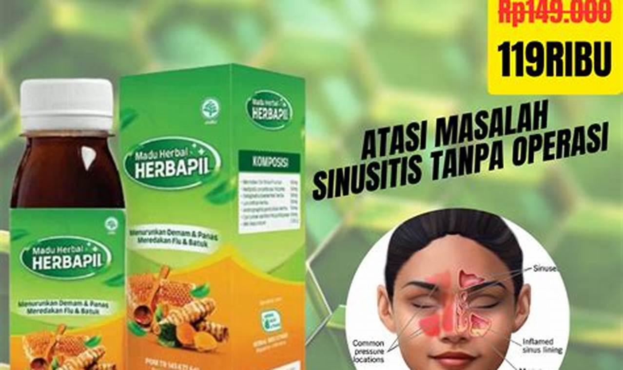 Natural Herbal Cure for Sinusitis: Relief + Tips The Ultimate Herbal Remedies Guide: Natural Healing for a Healthier Life Natural Herbal Cure for Sinusitis: Relief + Tips | The Ultimate Herbal Remedies Guide: Natural Healing for a Healthier Life