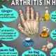 Natural Herbal Remedies for Arthritis in Fingers: Relief Now! | The Ultimate Herbal Remedies Guide: Natural Healing for a Healthier Life