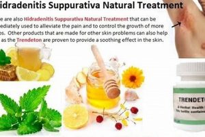 Natural Hidradenitis Suppurativa Herbal Treatment Relief The Ultimate Herbal Remedies Guide: Natural Healing for a Healthier Life Natural Hidradenitis Suppurativa Herbal Treatment Relief | The Ultimate Herbal Remedies Guide: Natural Healing for a Healthier Life