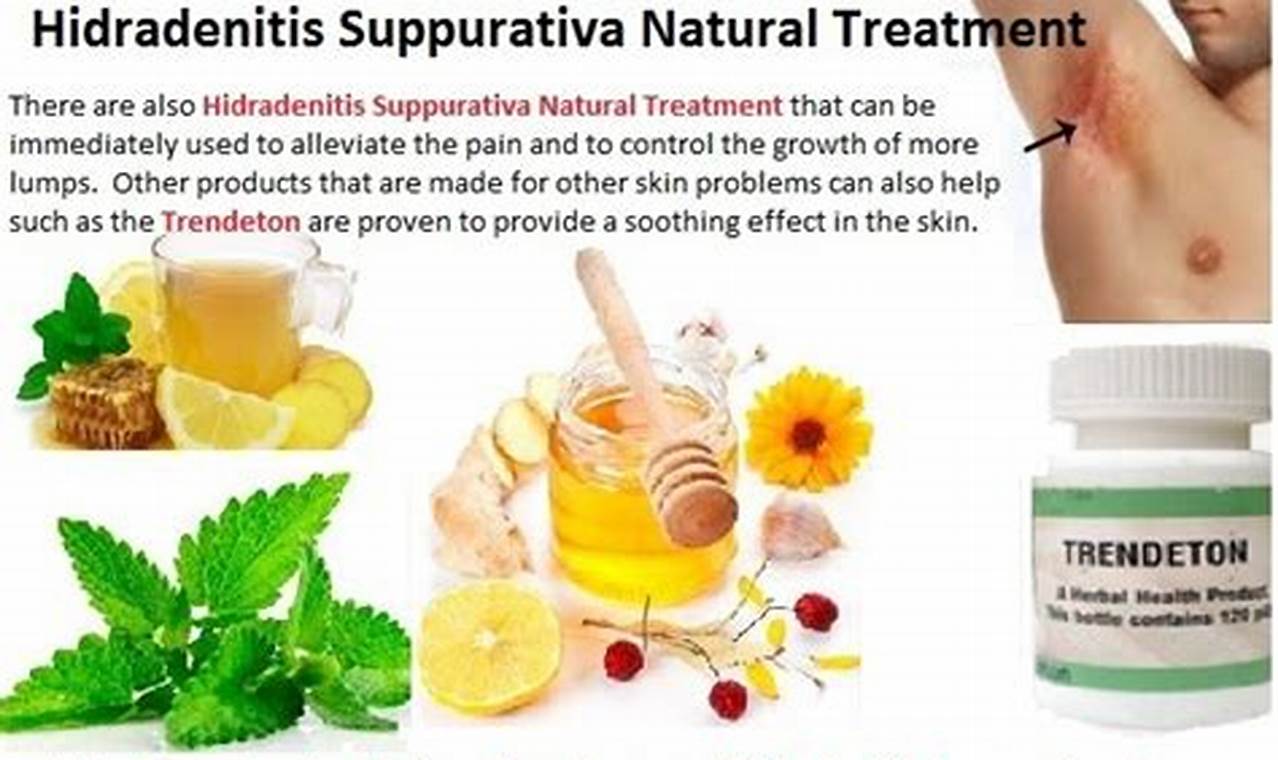 Natural Hidradenitis Suppurativa Herbal Treatment Relief The Ultimate Herbal Remedies Guide: Natural Healing for a Healthier Life Natural Hidradenitis Suppurativa Herbal Treatment Relief | The Ultimate Herbal Remedies Guide: Natural Healing for a Healthier Life