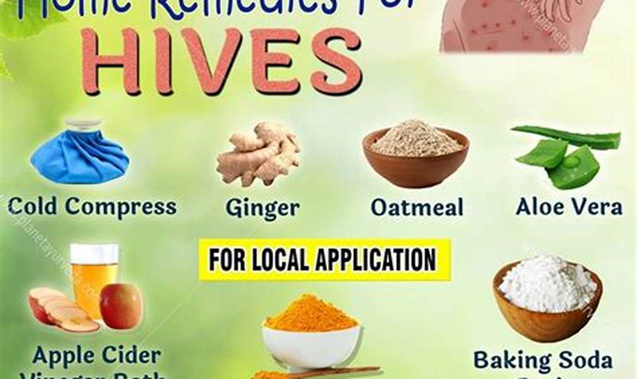 Natural Hives Herbal Remedies: Soothe The Itch Today! | The Ultimate Herbal Remedies Guide: Natural Healing for a Healthier Life