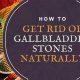 Natural: Gallbladder Stones Herbal Treatment Options + | The Ultimate Herbal Remedies Guide: Natural Healing for a Healthier Life