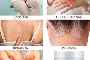 Natural Herbal Antifungal Supplement: Uses & Benefits | The Ultimate Herbal Remedies Guide: Natural Healing for a Healthier Life