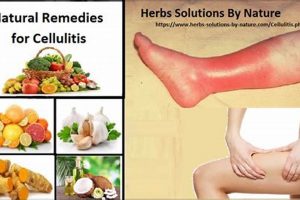 Natural Herbal Remedies for Cellulitis Relief Today | The Ultimate Herbal Remedies Guide: Natural Healing for a Healthier Life