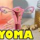 Natural Herbals: Herbal Remedies for Myoma Relief | The Ultimate Herbal Remedies Guide: Natural Healing for a Healthier Life
