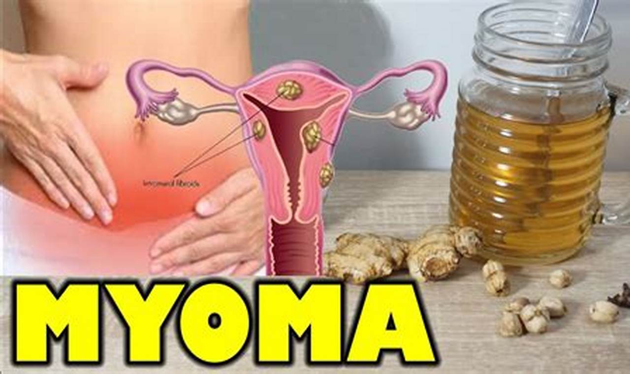 Natural Herbals: Herbal Remedies for Myoma Relief The Ultimate Herbal Remedies Guide: Natural Healing for a Healthier Life Natural Herbals: Herbal Remedies for Myoma Relief | The Ultimate Herbal Remedies Guide: Natural Healing for a Healthier Life
