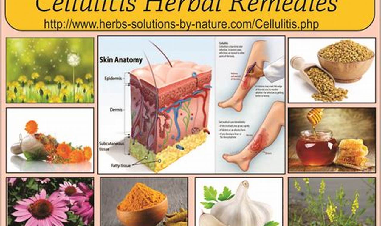 Natural Herbal Remedy for Cellulitis: Uses & Relief The Ultimate Herbal Remedies Guide: Natural Healing for a Healthier Life Natural Herbal Remedy for Cellulitis: Uses & Relief | The Ultimate Herbal Remedies Guide: Natural Healing for a Healthier Life