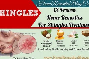 Natural Herbal Shingles Treatment: Relief & Remedies The Ultimate Herbal Remedies Guide: Natural Healing for a Healthier Life Natural Herbal Shingles Treatment: Relief & Remedies | The Ultimate Herbal Remedies Guide: Natural Healing for a Healthier Life