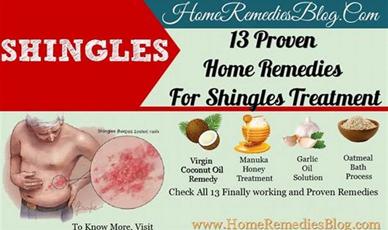 Natural Herbal Shingles Treatment: Relief & Remedies The Ultimate Herbal Remedies Guide: Natural Healing for a Healthier Life Natural Herbal Shingles Treatment: Relief & Remedies | The Ultimate Herbal Remedies Guide: Natural Healing for a Healthier Life