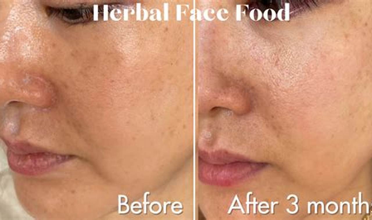 See Real Herbal Face Food Before & After Results: Does it Work? The Ultimate Herbal Remedies Guide: Natural Healing for a Healthier Life See Real Herbal Face Food Before & After Results: Does it Work? | The Ultimate Herbal Remedies Guide: Natural Healing for a Healthier Life