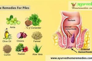 Natural Herbal Remedies for Hemorrhoids in Women - Relief! The Ultimate Herbal Remedies Guide: Natural Healing for a Healthier Life Natural Herbal Remedies for Hemorrhoids in Women - Relief! | The Ultimate Herbal Remedies Guide: Natural Healing for a Healthier Life