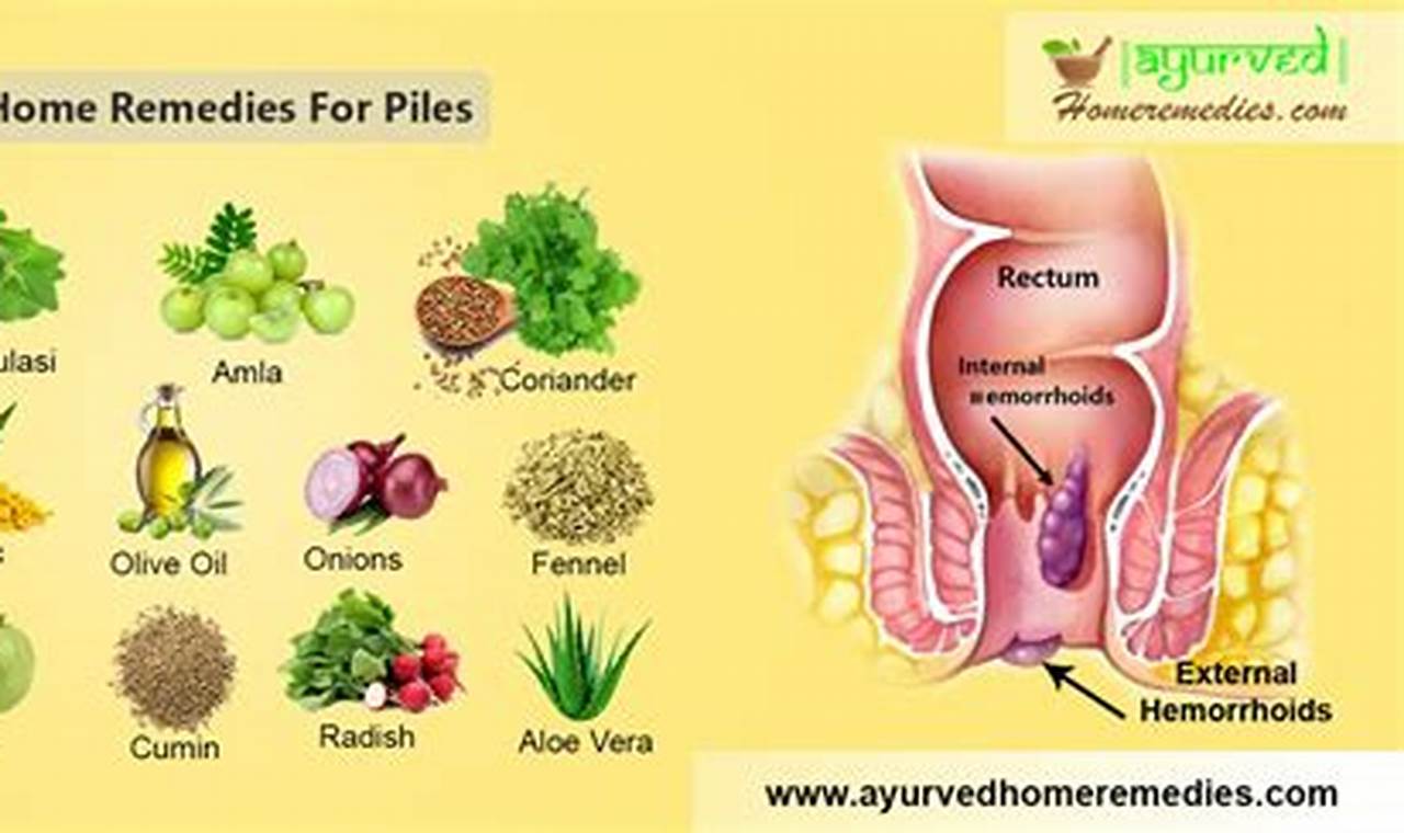 Natural Herbal Remedies for Hemorrhoids in Women - Relief! | The Ultimate Herbal Remedies Guide: Natural Healing for a Healthier Life