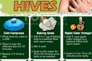 Natural Herbal Cure for Hives: Relief & Remedies | The Ultimate Herbal Remedies Guide: Natural Healing for a Healthier Life