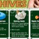 Natural Herbal Cure for Hives: Relief & Remedies | The Ultimate Herbal Remedies Guide: Natural Healing for a Healthier Life