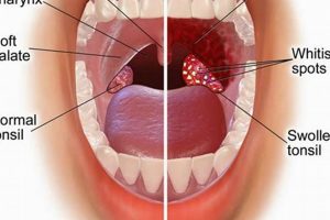 Natural Herbal Remedy Strep Throat Guide & Relief | The Ultimate Herbal Remedies Guide: Natural Healing for a Healthier Life