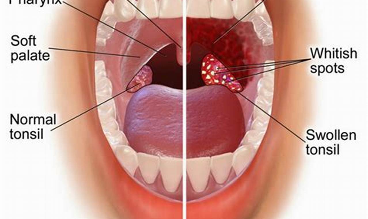Natural Herbal Remedy Strep Throat Guide & Relief | The Ultimate Herbal Remedies Guide: Natural Healing for a Healthier Life