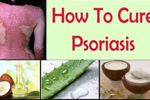Best Natural Herbal Treatment for Psoriasis: Relief Guide | The Ultimate Herbal Remedies Guide: Natural Healing for a Healthier Life