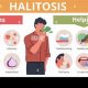 Natural Herbal Treatment for Halitosis: Fresh Breath Now! | The Ultimate Herbal Remedies Guide: Natural Healing for a Healthier Life