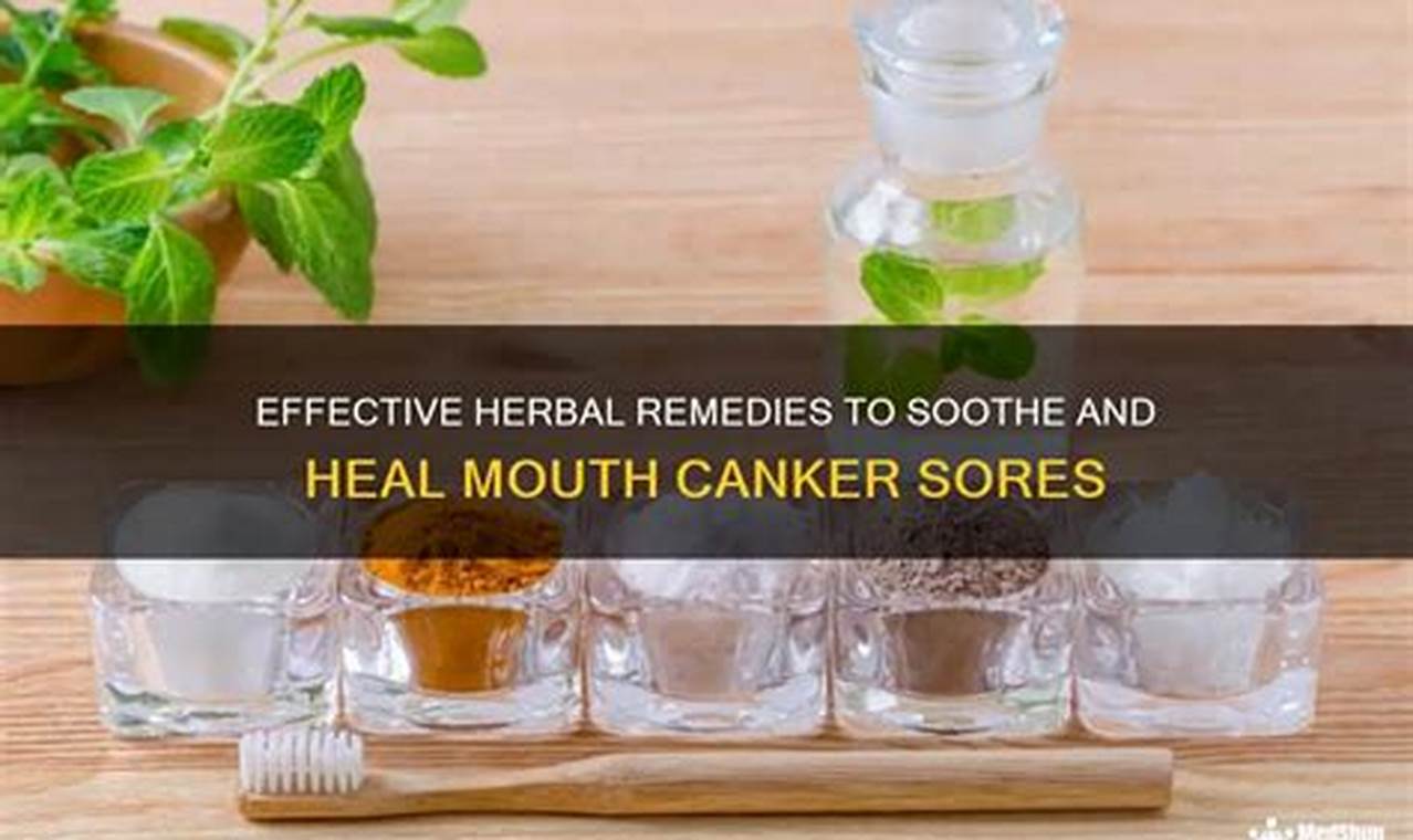 Natural Herbal Remedies for Canker Sores + Relief | The Ultimate Herbal Remedies Guide: Natural Healing for a Healthier Life