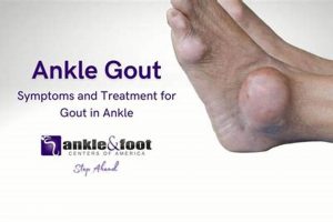 Natural Herbal Treatment for Gout in Foot: Relief Now | The Ultimate Herbal Remedies Guide: Natural Healing for a Healthier Life