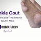 Natural Herbal Treatment for Gout in Foot: Relief Now | The Ultimate Herbal Remedies Guide: Natural Healing for a Healthier Life