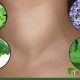 Natural Hyperthyroidism Herbal Remedies: Relief + Risks | The Ultimate Herbal Remedies Guide: Natural Healing for a Healthier Life
