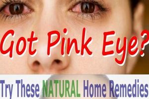 Quick Herbal Remedy for Pink Eye Relief Tips The Ultimate Herbal Remedies Guide: Natural Healing for a Healthier Life Quick Herbal Remedy for Pink Eye Relief Tips | The Ultimate Herbal Remedies Guide: Natural Healing for a Healthier Life