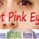 Quick Herbal Remedy for Pink Eye Relief Tips | The Ultimate Herbal Remedies Guide: Natural Healing for a Healthier Life