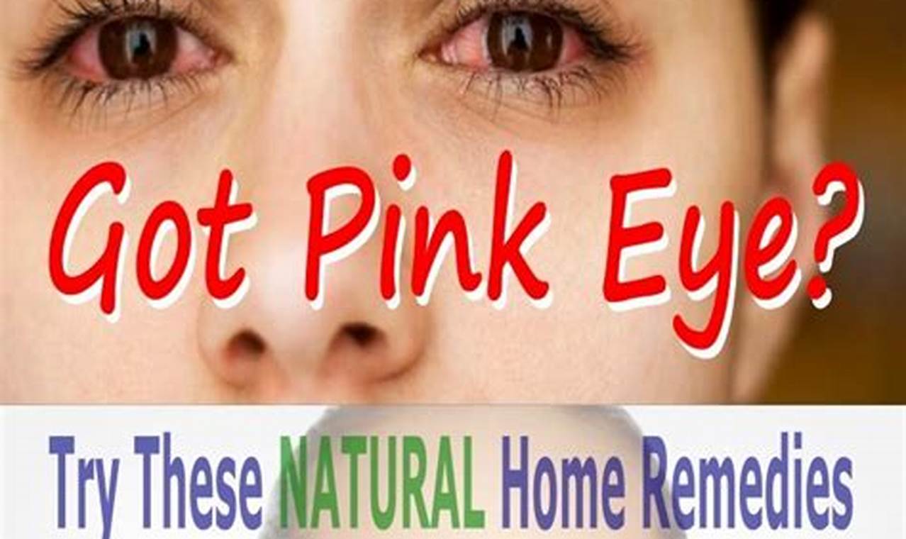 Quick Herbal Remedy for Pink Eye Relief Tips The Ultimate Herbal Remedies Guide: Natural Healing for a Healthier Life Quick Herbal Remedy for Pink Eye Relief Tips | The Ultimate Herbal Remedies Guide: Natural Healing for a Healthier Life