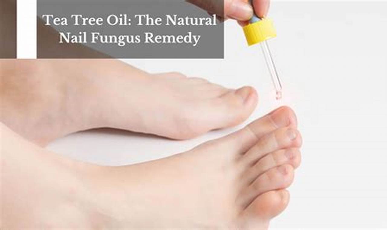 Natural Herbal Remedy for Nail Fungus: Cure & Tips The Ultimate Herbal Remedies Guide: Natural Healing for a Healthier Life Natural Herbal Remedy for Nail Fungus: Cure & Tips | The Ultimate Herbal Remedies Guide: Natural Healing for a Healthier Life