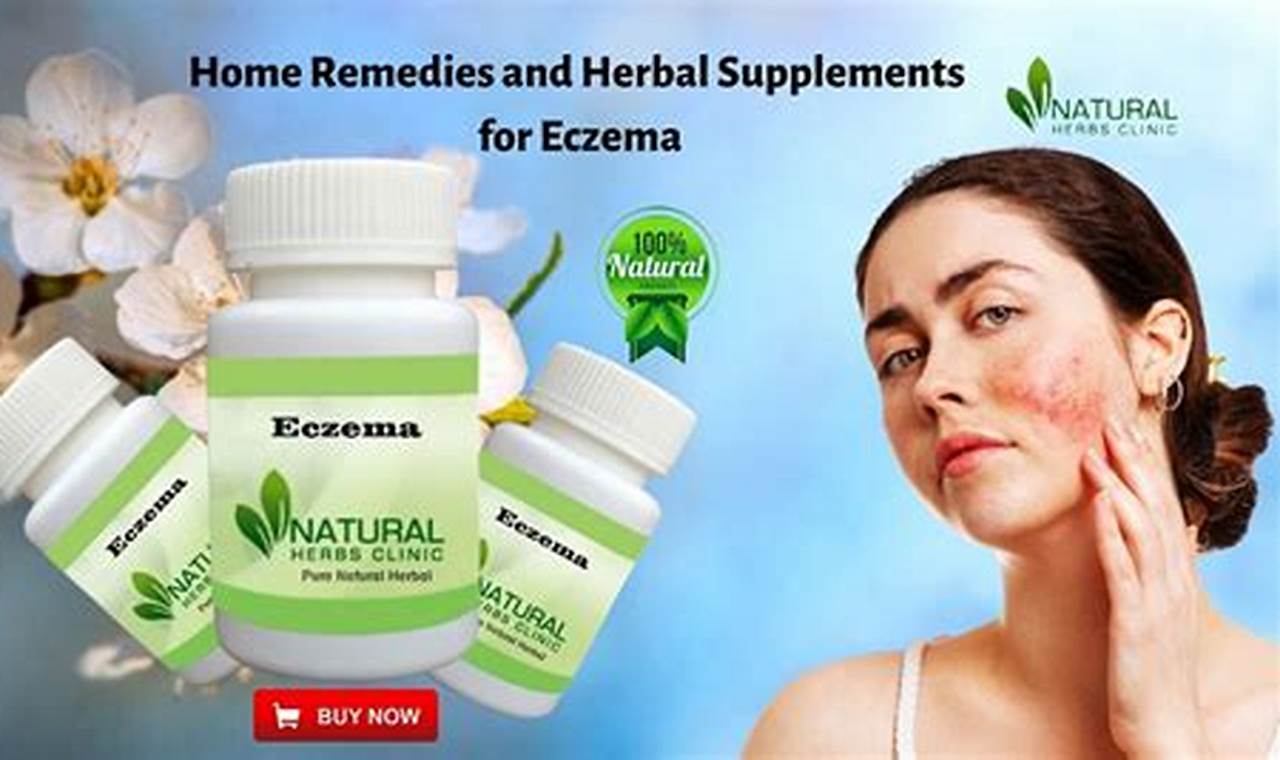 Natural Eczema Herbal Supplements: Relief & Support | The Ultimate Herbal Remedies Guide: Natural Healing for a Healthier Life