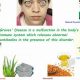 Natural Graves Disease Herbal Treatment Guide | The Ultimate Herbal Remedies Guide: Natural Healing for a Healthier Life